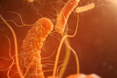 MenuWorks Uses Antimicrobial Protection MenuWorks Uses Antimicrobial Protection